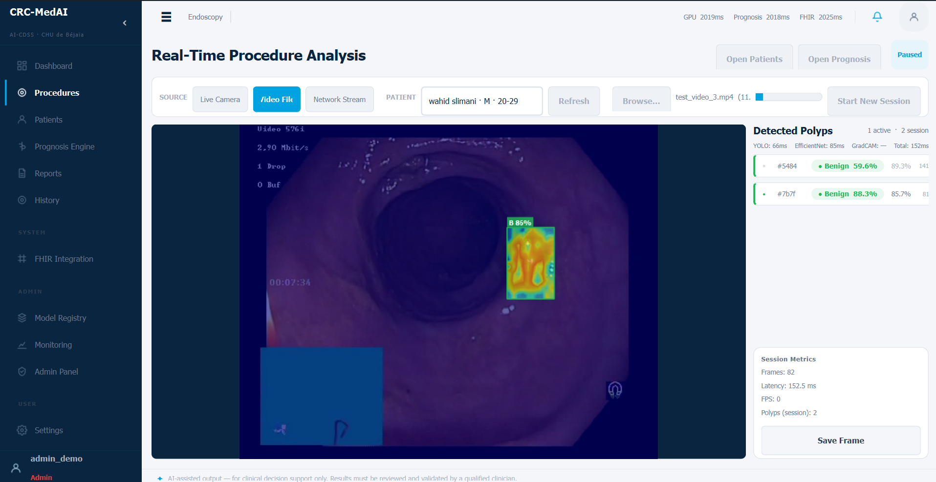 CRC-MedAI: Real-time procedure analysis: Grad-CAM heatmaps and live polyp detection with bounding boxes and confidence, straight off the endoscopy stream.